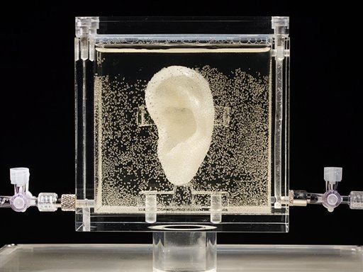 Museum Displays Ear Grown From Van Gogh DNA
