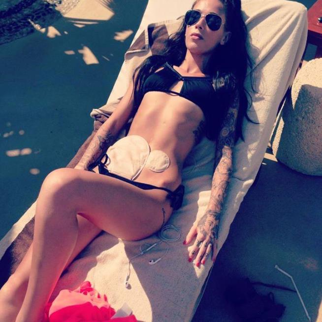 Aspiring Model Poses With Colostomy Bags