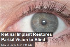 Retinal Implant Restores Partial Vision to Blind