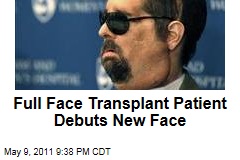 Full Face Transplant Patient Dallas Wiens Debuts New Face