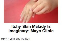Itchy Skin Malady Known as Morgellons Is 'Delusional,' Say Mayo Clinic Researchers