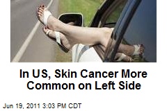 In US, Skin Cancer More Common on Left Side