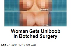 Woman Gets Uniboob in Botched Surgery