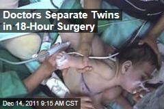 Chilean Doctors Separate Conjoined Twins in 18-Hour Operation