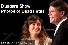 Duggars Show Photos of Dead Fetus