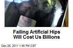 Failing Artificial Hips Will Cost Us Billions