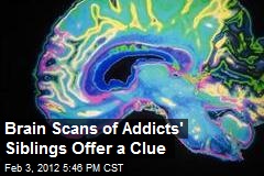 Brain Scans of Addicts&#39; Siblings Offer a Clue