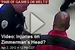 Video: Injuries on Zimmerman&#39;s Head?