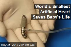 World&#39;s Smallest Artificial Heart Saves Baby&#39;s Life