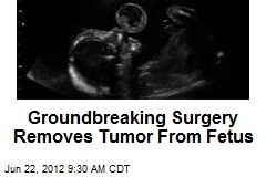 Groundbreaking Surgery Removes Tumor From Fetus