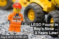 LEGO Found in Boy&#39;s Nose ... 3 Years Later