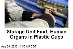 Storage Unit Find: Human Organs in Plastic Cups