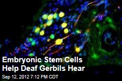 Embryonic Stem Cells Help Deaf Gerbils Hear