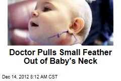 Doctor Pulls Small Feather Out of Baby&#39;s Neck