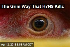 The Grim Way That H7N9 Kills
