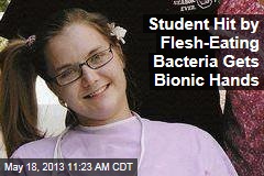 Student Hit by Flesh-Eating Bacteria Gets Bionic Hands