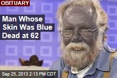 Man Whose Skin Was Blue Dead at 62