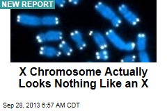 X Chromosome Actually Looks Nothing Like an X