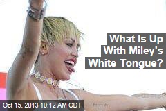 What Is Up With Miley&#39;s White Tongue?