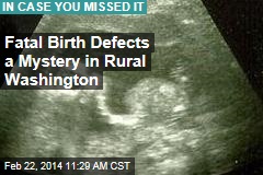 Cluster of fatal birth defects a mystery in rural Washington
