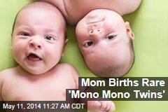 Mom Births Rare &#39;Mono Mono Twins&#39;