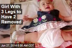 Girl With 3 Legs to Have 2 Removed