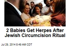 2 Babies Get Herpes After Jewish Circumcision Ritual