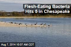 Flesh-Eating Bacteria Hits 5 in Chesapeake