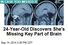 24-Year-Old Discovers She&#39;s Missing Key Part of Brain