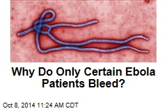 Why Do Only Certain Ebola Patients Bleed?