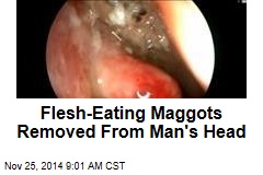 Flesh-Eating Maggots Removed From Man&#39;s Head