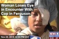 Woman Loses Eye in Encounter With Cop in Ferguson