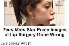 Teen Mom Star Posts Images of Lip Surgery Gone Wrong