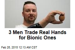 3 Men Trade Real Hands for Bionic Ones