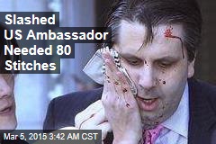 Slashed US Ambassador in Stable Condition