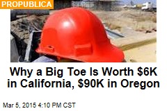 Why a Big Toe Is Worth $6K in California, $90K in Oregon