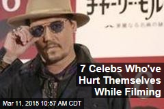 7 Celebs Who&#39;ve Hurt Themselves While Filming