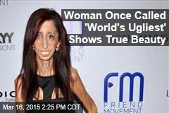 Woman Once Called &#39;World&#39;s Ugliest&#39; Shows True Beauty