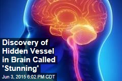 Discovery of Hidden Vessel in Brain Called &#39;Stunning&#39;