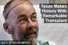 Texas Makes History With Skull, Scalp Transplant