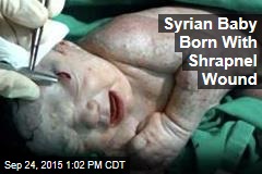 Syrian Baby Born With Shrapnel Wound