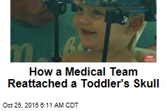 How a Medical Team Reattached a Toddler&#39;s Skull