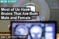 Study: Most of Us Have Brains That Are Both Male and Female