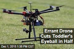 Errant Drone Cuts Toddler&#39;s Eyeball in Half