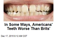 In Some Ways, Americans&#39; Teeth Worse Than Brits&#39;