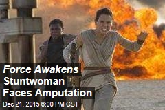 Force Awakens Stuntwoman to Lose an Arm
