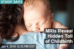 MRIs Reveal Hidden Toll of Childbirth