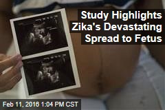 Study Highlights Zika&#39;s Devastating Spread to Fetus