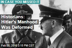 Historians: Hitler&#39;s Manhood Was Small, Deformed