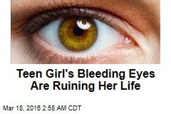 Teen Girl&#39;s Bleeding Eyes Are Ruining Her Life